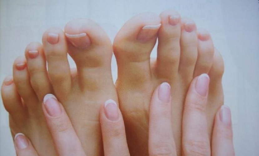 Remedios caseros para los hongos de las uñas de los pies