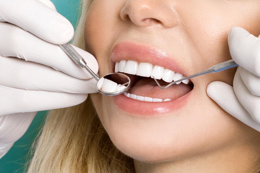 ¿Cuánto vale un implante dental completo?