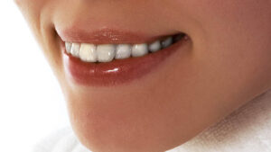 ¿Cuánto vale un implante dental completo?